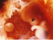 婴灵超度：缘分未到孩子自然流产，人生陷入绝境