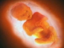 婴灵超度：女性堕胎灵婴缠身 如何超度灵婴