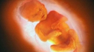 婴灵超度：女性堕胎灵婴缠身 如何超度灵婴