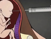 婴灵超度：自己堕胎又开人流诊所，灾祸连连